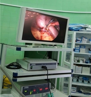 راه اندازی دستگاه لاپراسکوپی در بیمارستان امام خمینی دهدشت