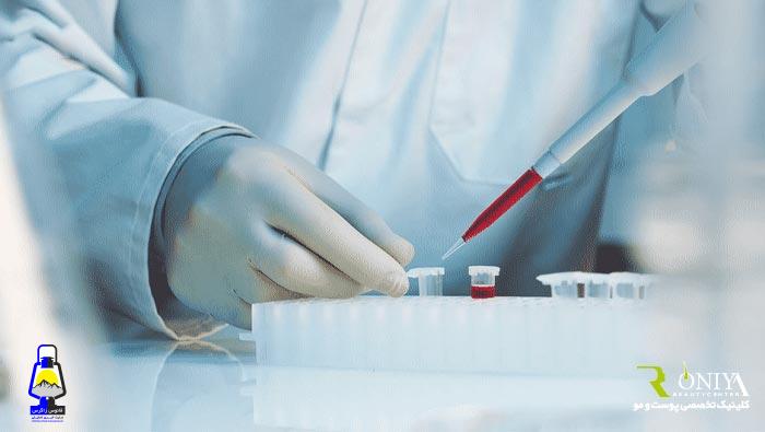 آشنایی با جدیدترین روش های کاشت مو