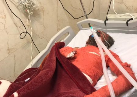 خودسوزی فرزند شهید جلوی بنیاد شهید کهگیلویه و بویراحمد/دستور استاندار جهت بررسی موضوع /توضیحات مدیرکل بنیاد شهید استان کهگیلویه و بویراحمد/واکنش نماینده بویراحمد و دنا به خودسوزی فرزند شهید