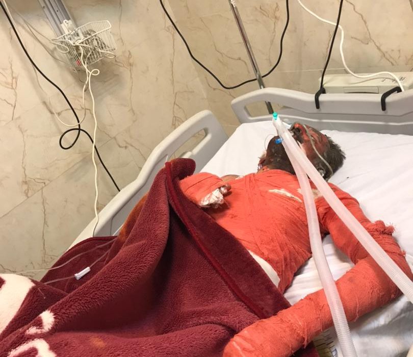 خودسوزی فرزند شهید جلوی بنیاد شهید کهگیلویه و بویراحمد/دستور استاندار جهت بررسی موضوع /توضیحات مدیرکل بنیاد شهید استان کهگیلویه و بویراحمد/واکنش نماینده بویراحمد و دنا به خودسوزی فرزند شهید