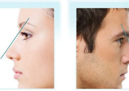 در ایران کدام الگوی بینی و چانه، جذاب است؟