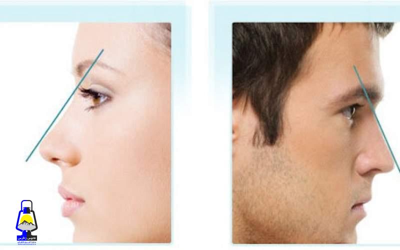 در ایران کدام الگوی بینی و چانه، جذاب است؟