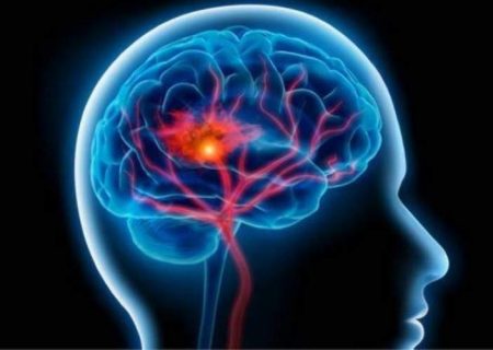 شیوع یک بیماری “مرموز” مغزی در کانادا