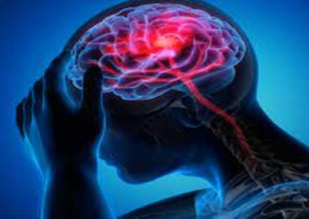 چند راهکار ساده برای پیشگیری از سکته مغزی