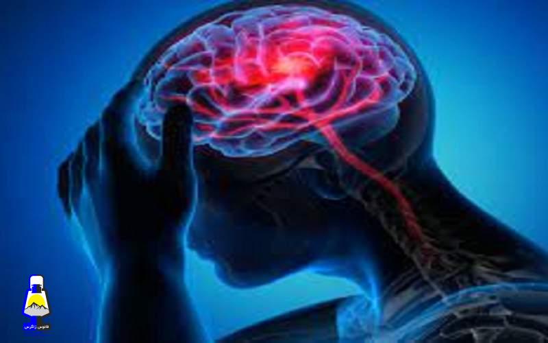 چند راهکار ساده برای پیشگیری از سکته مغزی