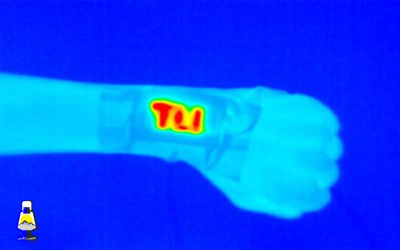 گرمای قابل حمل در یک مچبند حرارتی!