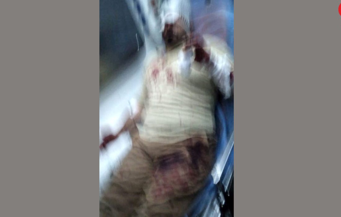 ناگفته های مرد روحانی از حمله خونین پسران ۱۶ ساله در پارک / در تهرانپارس رخ داد + عکس