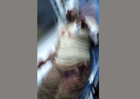 ناگفته های مرد روحانی از حمله خونین پسران ۱۶ ساله در پارک / در تهرانپارس رخ داد + عکس