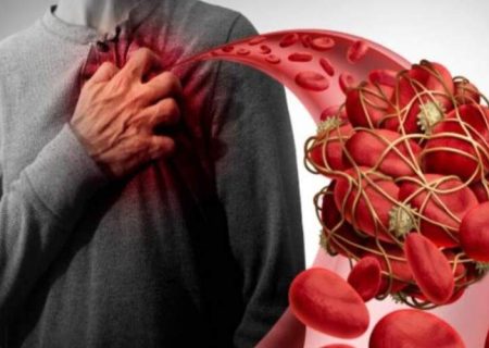 لخته خون چه کسانی را تهدید می‌کند؟