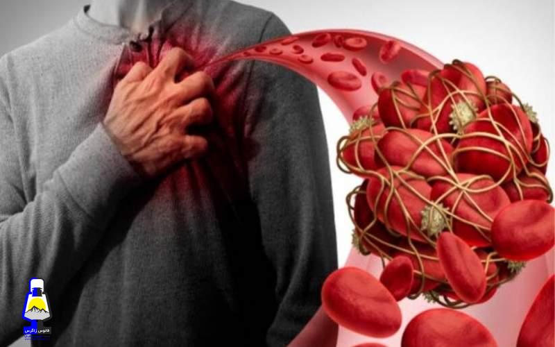لخته خون چه کسانی را تهدید می‌کند؟