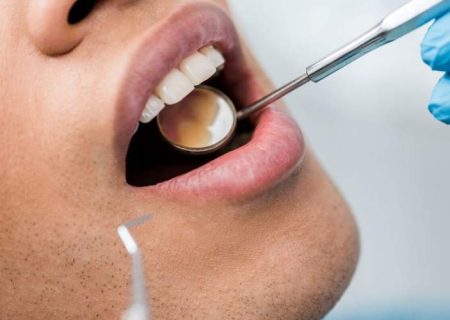 ویروس کرونا به دندان‌ها هم آسیب می‌رساند؟