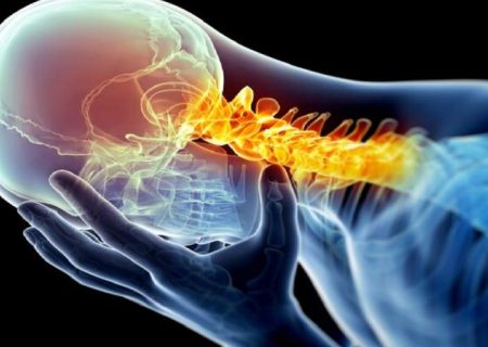 یک علامت شایع در مبتلایان به میگرن مزمن