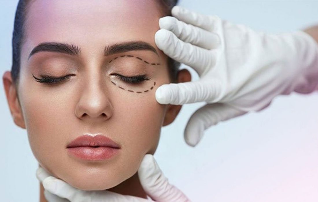 لیفت پلک چیست ؟