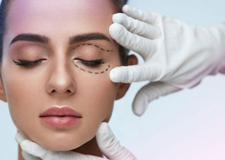 لیفت پلک چیست ؟