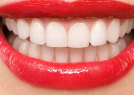 بهترین دندانپزشک زیبایی در تبریز