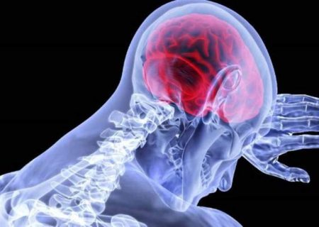 آیا ضربات متعدد به سر موجب آلزایمر می‌شود؟