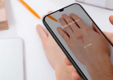 بررسی سلامت پوست با دوربین گوشی
