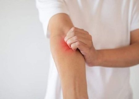 زهر زنبور عسل عملکردی مانند آنتی‌بیوتیک دارد