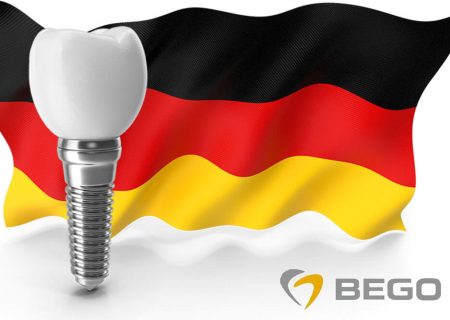قیمت ایمپلنت آلمانی بگو