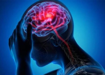 علائم هشدار دهنده سکته مغزی چیست؟