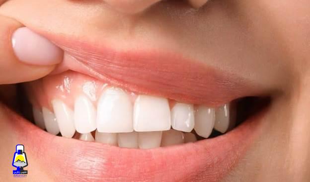 راز لبخند جذاب؛ چرا کامپوزیت دندان این‌قدر محبوب شده است؟