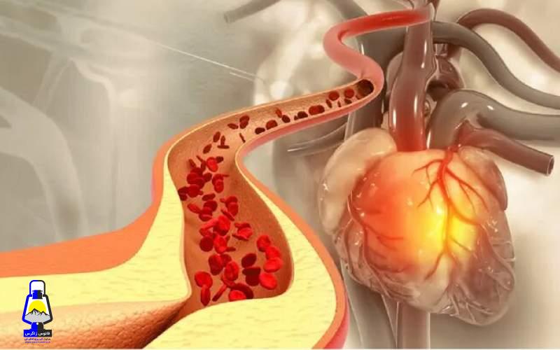 یک روش ساده برای کاهش کلسترول خون