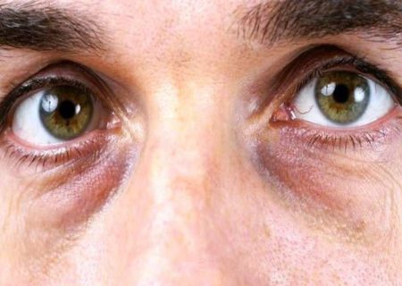 افزایش خطر بیماری‌های چشمی با افزایش سن