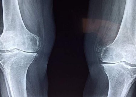 چند هشدار سلامتی برای افراد بالای ۵۰ سال