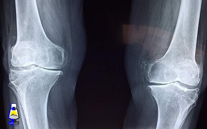 چند هشدار سلامتی برای افراد بالای ۵۰ سال