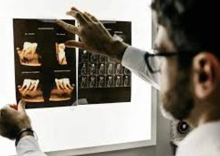 کلید مولکولی آلزایمر پیدا شد