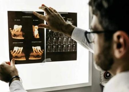 کلید مولکولی آلزایمر کشف شد