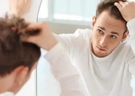 ۵ خوراکی که باعث ریزش مو می‌شوند