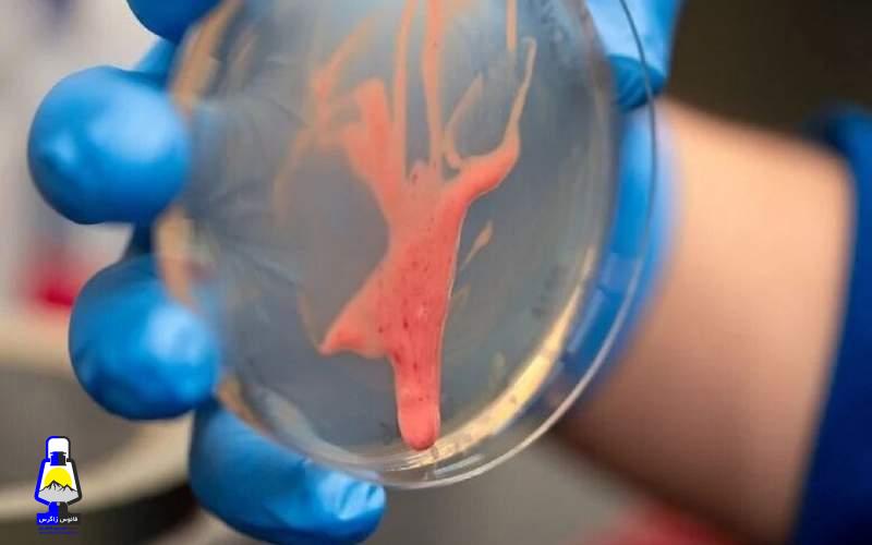 این باکتری گیاهان را از پا درمیآورد