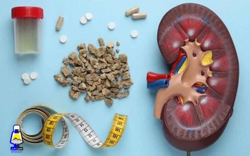 این مواد غذایی باعث تشکیل سنگ کلیه میشوند