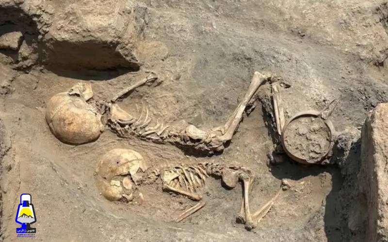 جراحی جمجمه در ۴۰۰۰ سال پیش!