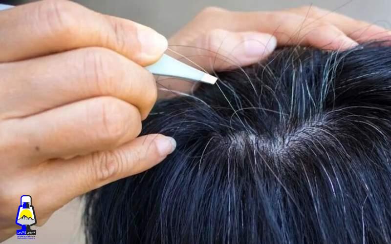 ۷ ترفند برای خداحافظی با موهای سفید